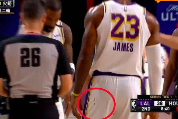 詹姆斯两罚全丢 哈登助威少空接暴扣 湖人悍将出血染詹皇球裤【ky开元电竞】(图6)
詹姆斯两罚全丢 哈登助威少空接暴扣 湖人悍将出血染詹皇球裤【ky开元电竞】(图6)